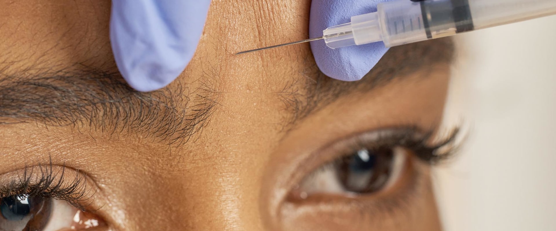 What Are The Benefits And Risks Of Botox Injections?